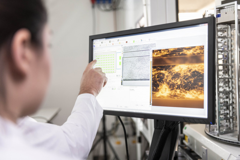 Arts kijkt op computer naar analyse van stalen in kankeronderzoek